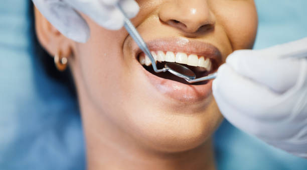 Best Root Canal Treatment  in Riverside, OH